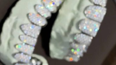 Diamonds in Teeth: Trend, Costs, and Care Tips Explained